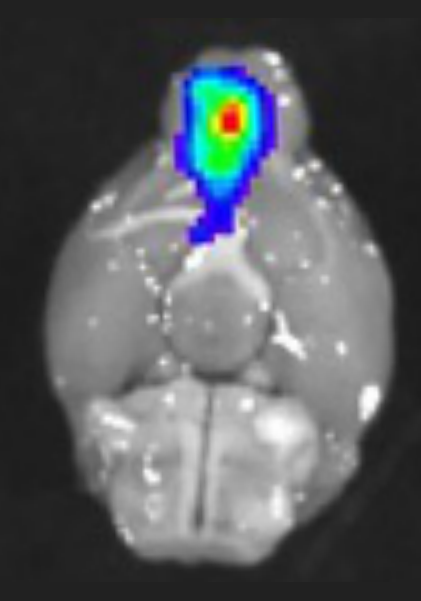 Fluorescence image of a mouse brain one hour after a nasal dose of labelled tirzepatide nanoparticles