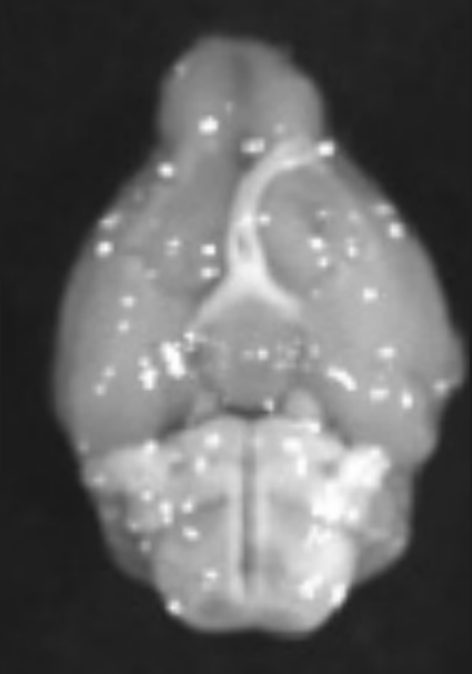 Fluorescence image of a mouse brain one hour after vehicle